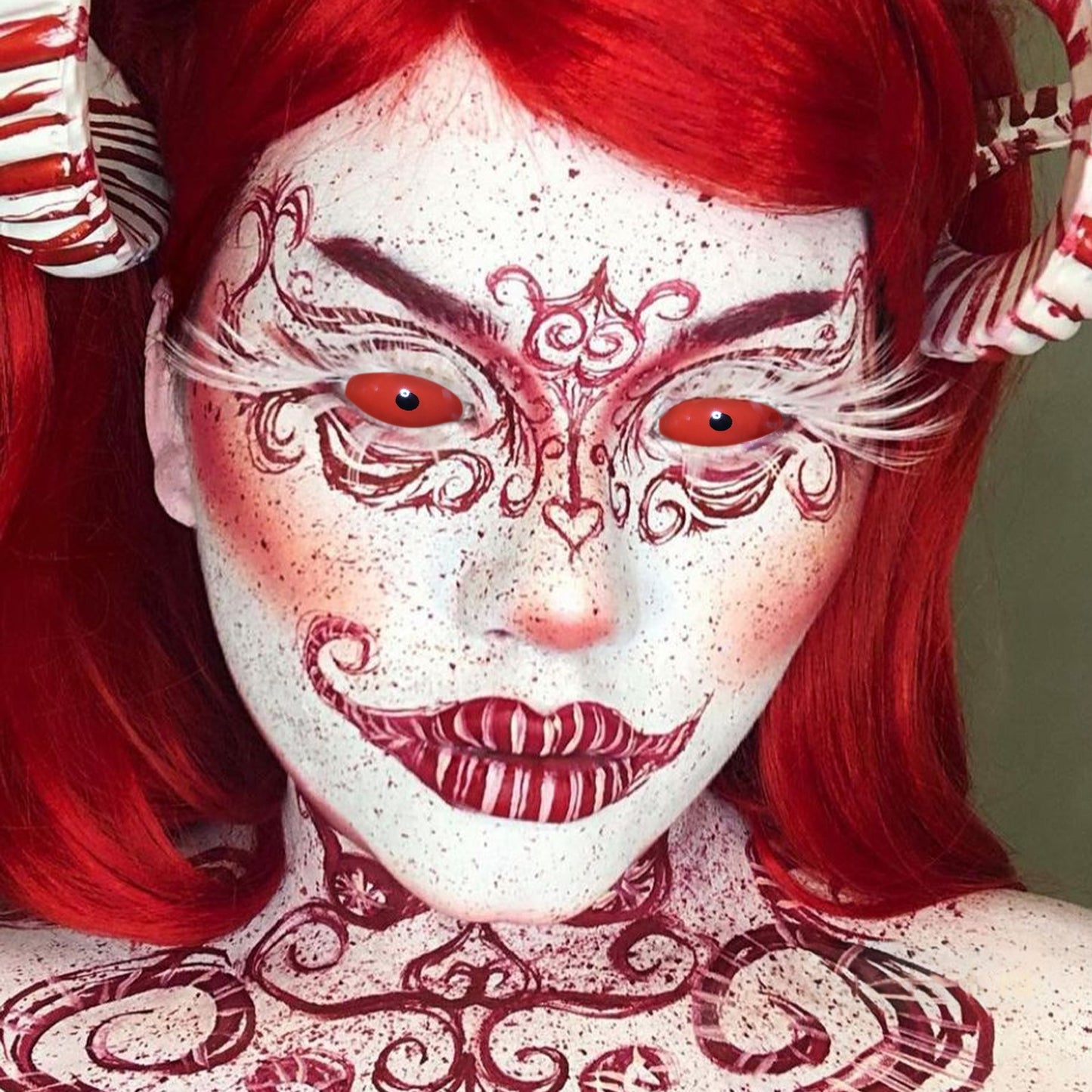 RED SCLERA