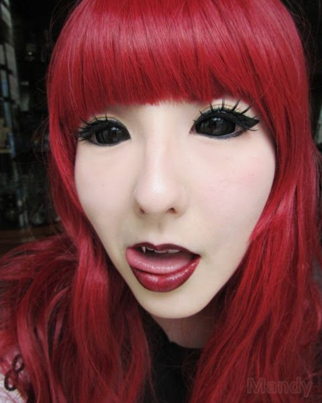 BLACK SCLERA